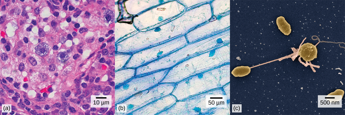 Figure 1. (a) Nasal sinus cells (viewed with a light microscope), (b) onion cells (viewed with a light microscope), and (c) Vibrio tasmaniensis bacterial cells (seen through a scanning electron microscope) are from very different organisms, yet all share certain basic cell structure characteristics. (credit a: modification of work by Ed Uthman, MD; credit b: modification of work by Umberto Salvagnin; credit c: modification of work by Anthony D’Onofrio, William H. Fowle, Eric J. Stewart, and Kim Lewis of the Lewis Lab at Northeastern University; scale-bar data from Matt Russell)